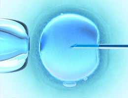 big-ticket-items-low-interest-financing-3-fertility-lg text