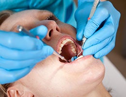 Dental treatments performed by nonprofessionals © Simone van den Berg/Shutterstock.com