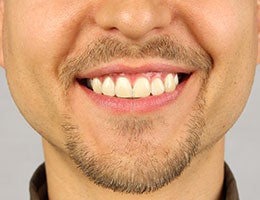 Facial hair © Trofimov Denis/Shutterstock.com